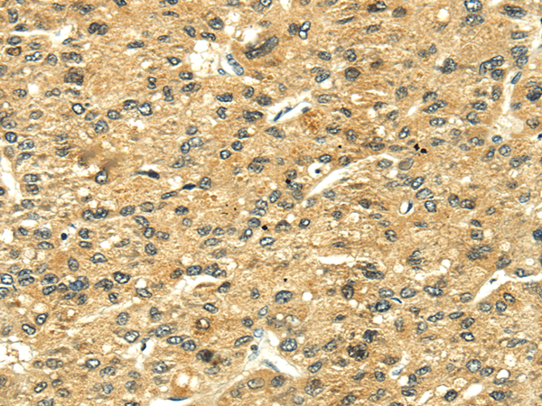 Rabbit Polyclonal Antibody to LEP
