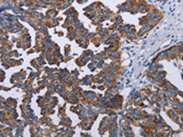 Rabbit Polyclonal Antibody to TRIM13