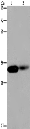 Rabbit Polyclonal Antibody to LIMS1