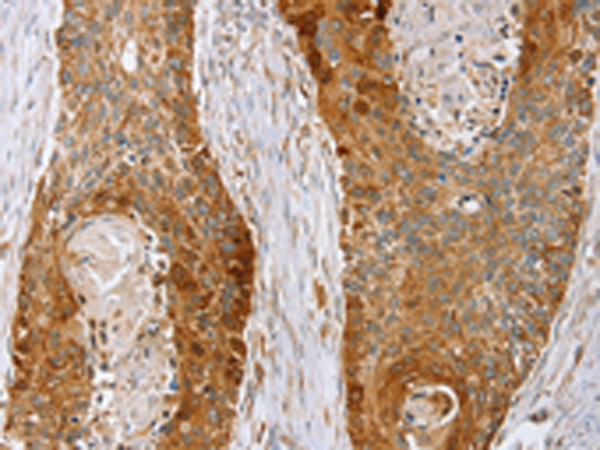 Rabbit Polyclonal Antibody to LMO4