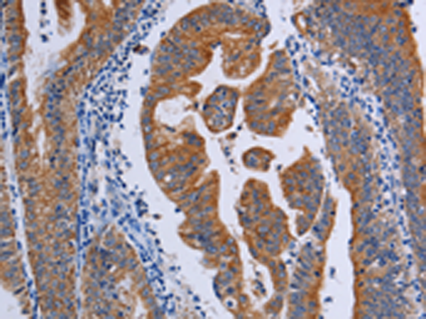 Rabbit Polyclonal Antibody to ACP6