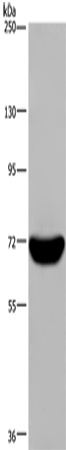 Rabbit Polyclonal Antibody to LCP1