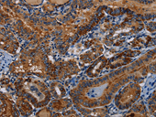 Rabbit Polyclonal Antibody to PIDD1