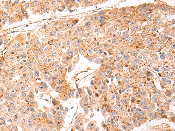Rabbit Polyclonal Antibody to LRRC15