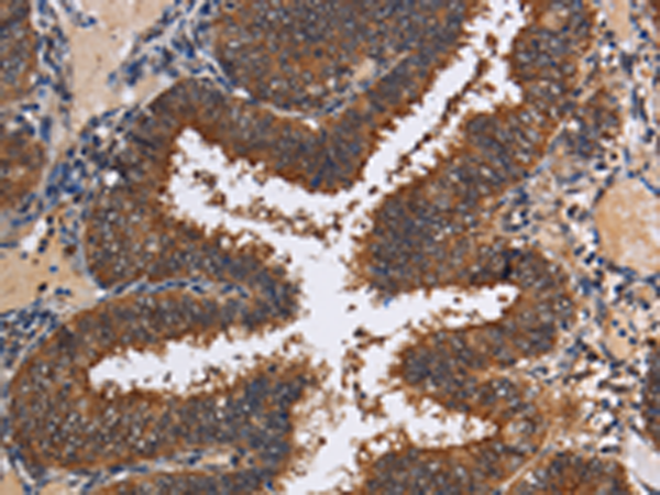 Rabbit Polyclonal Antibody to LRRC57