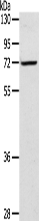 Rabbit Polyclonal Antibody to LTA4H