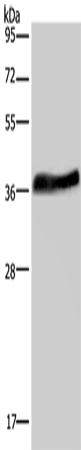 Rabbit Polyclonal Antibody to LUM