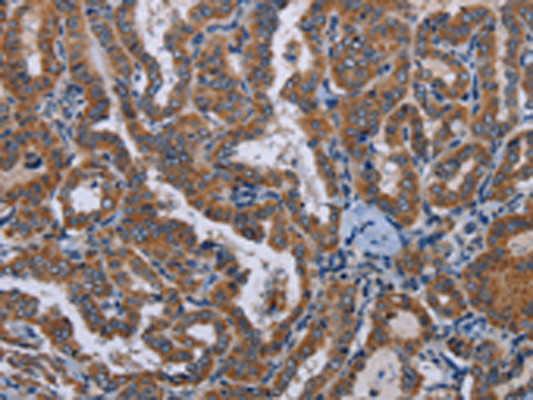 Rabbit Polyclonal Antibody to LYN