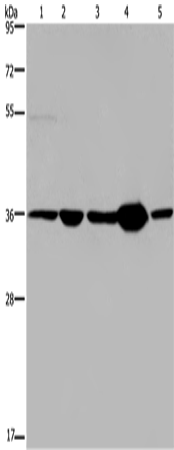Rabbit Polyclonal Antibody to LZTFL1