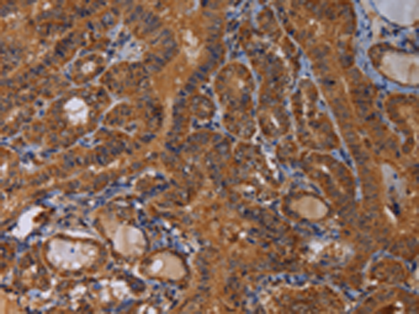 Rabbit Polyclonal Antibody to MAGEB10