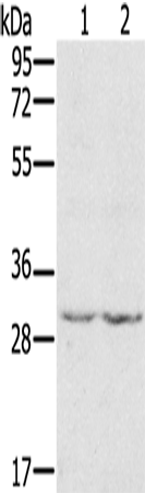 Rabbit Polyclonal Antibody to WDR83
