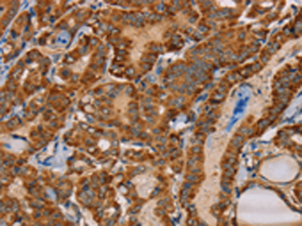 Rabbit Polyclonal Antibody to MBNL3