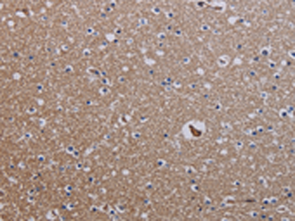 Rabbit Polyclonal Antibody to ZC3H12A