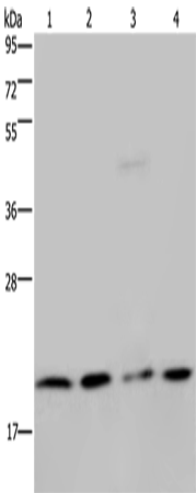Rabbit Polyclonal Antibody to MCTS1