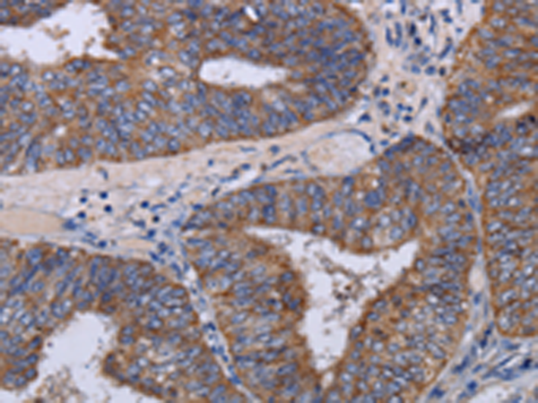 Rabbit Polyclonal Antibody to MT3