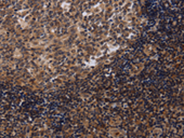 Rabbit Polyclonal Antibody to NTMT1