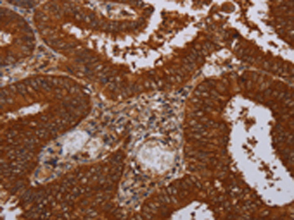 Rabbit Polyclonal Antibody to MFAP3L