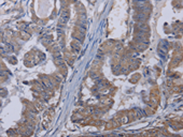 Rabbit Polyclonal Antibody to TRPM8