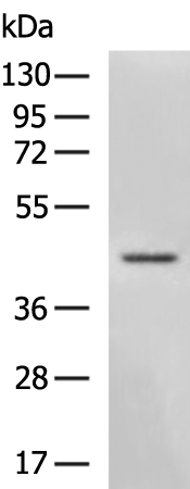 Rabbit Polyclonal Antibody to SERPINB3