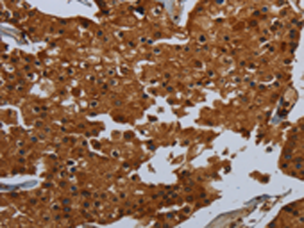Rabbit Polyclonal Antibody to ENTPD7