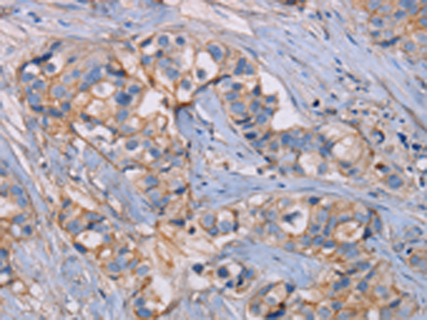Rabbit Polyclonal Antibody to GHITM