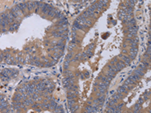 Rabbit Polyclonal Antibody to MKKS