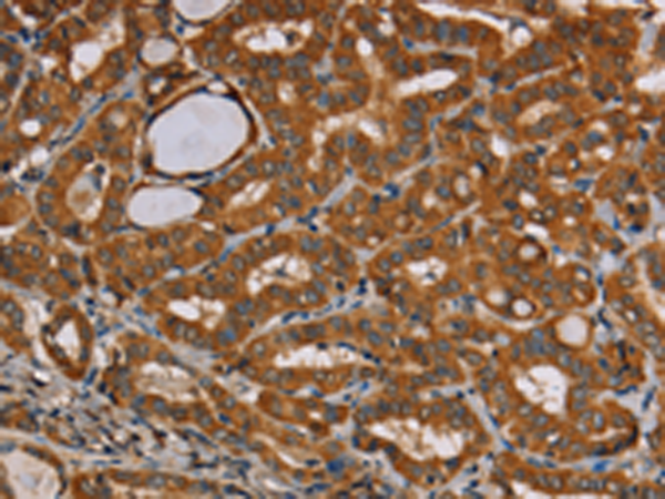 Rabbit Polyclonal Antibody to CENPU