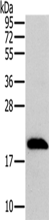 Rabbit Polyclonal Antibody to MRPL12