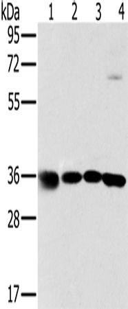 Rabbit Polyclonal Antibody to MRPL39