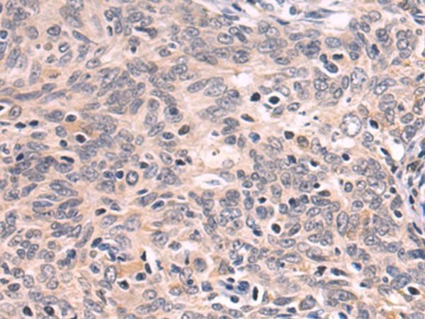 Rabbit Polyclonal Antibody to MSR1