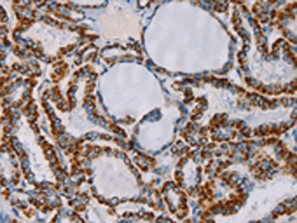 Rabbit Polyclonal Antibody to CMC4