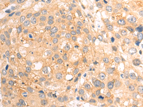 Rabbit Polyclonal Antibody to MTF1
