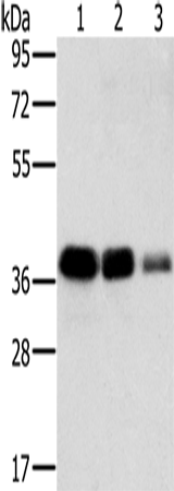 Rabbit Polyclonal Antibody to MTFR1