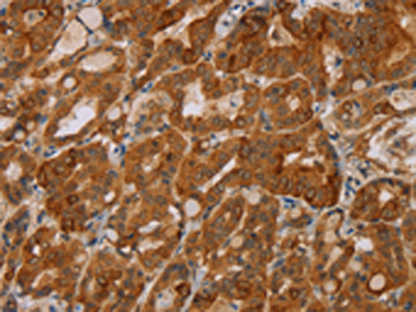 Rabbit Polyclonal Antibody to MTUS1