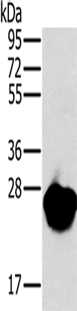 Rabbit Polyclonal Antibody to MYL3