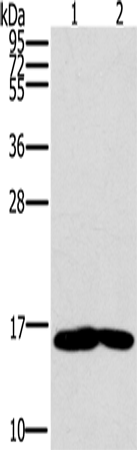 Rabbit Polyclonal Antibody to MB