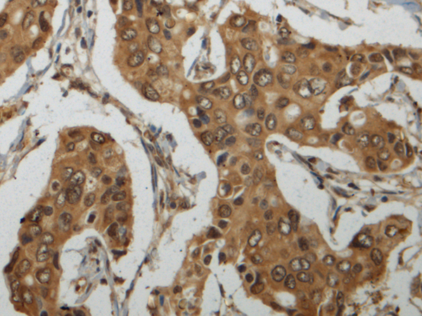 Rabbit Polyclonal Antibody to BEX3