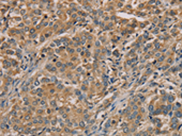 Rabbit Polyclonal Antibody to NANOS2