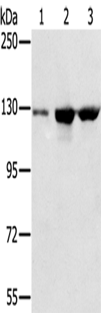 Rabbit Polyclonal Antibody to NAT10