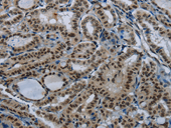 Rabbit Polyclonal Antibody to NBL1