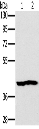 Rabbit Polyclonal Antibody to NDUFA10