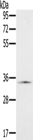 Rabbit Polyclonal Antibody to NDUFA9
