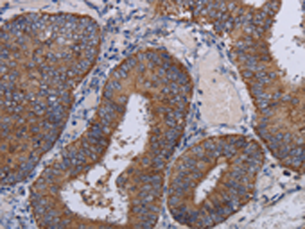 Rabbit Polyclonal Antibody to NDUFA1