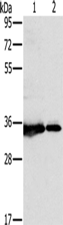 Rabbit Polyclonal Antibody to NDUFAF1