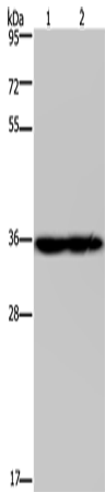 Rabbit Polyclonal Antibody to NDUFA9