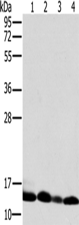 Rabbit Polyclonal Antibody to NDUFS5