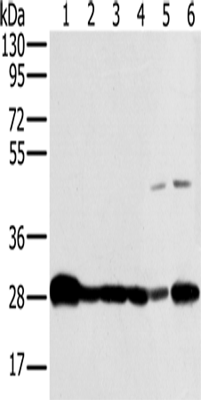 Rabbit Polyclonal Antibody to NDUFS3
