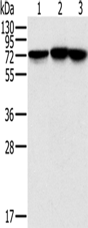 Rabbit Polyclonal Antibody to NDUFS1