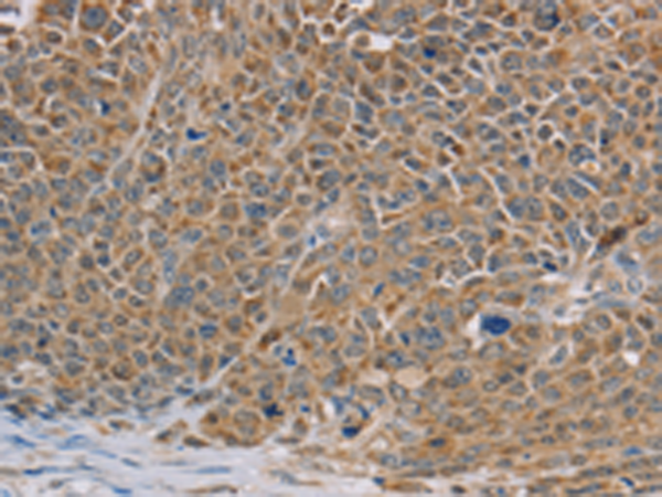 Rabbit Polyclonal Antibody to NDUFS7