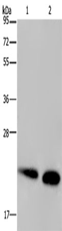 Rabbit Polyclonal Antibody to NDUFS4